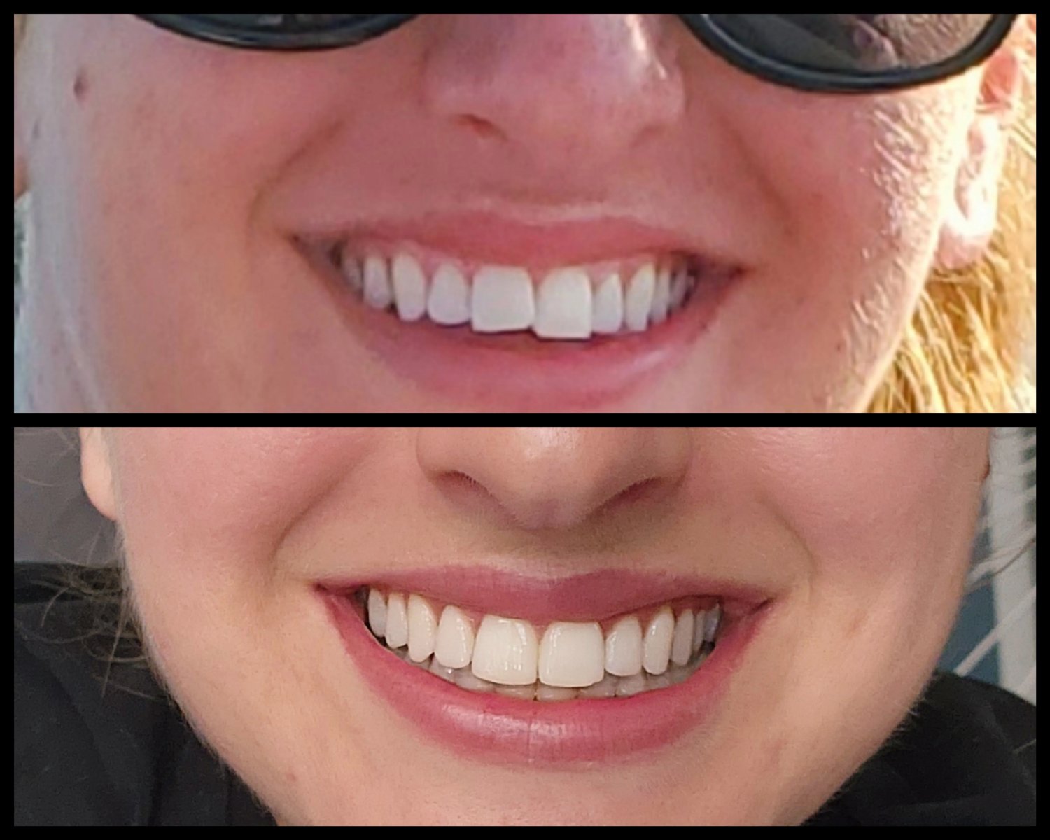 Random Reddit sluts part 1 ❤️ #OfSML6WS