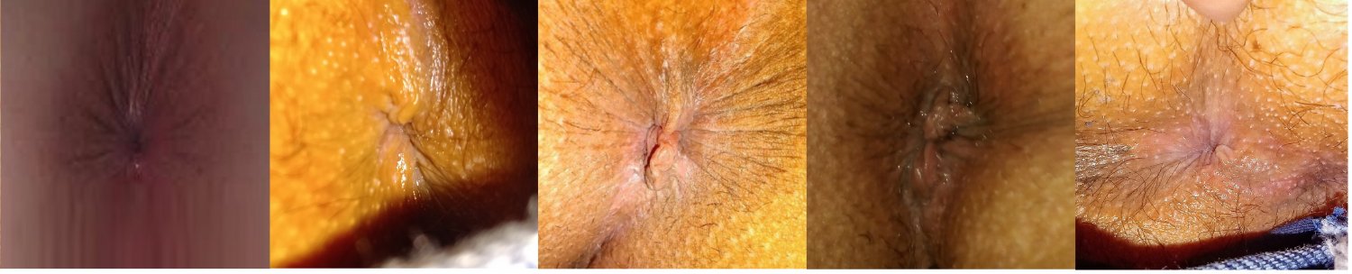 1 - my anus collection #9vibGp5K