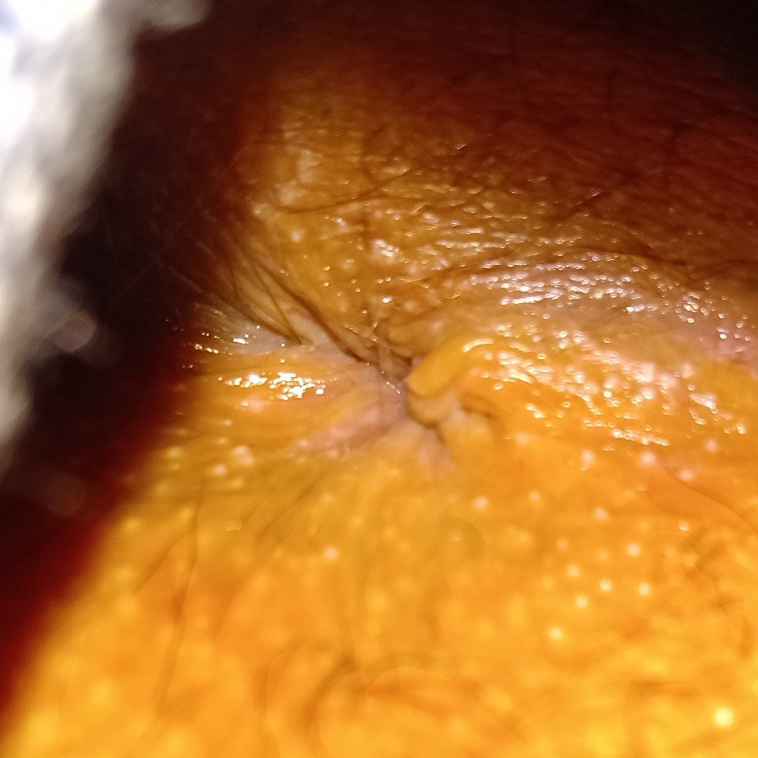 1 - my anus collection #Vi7m3iAb