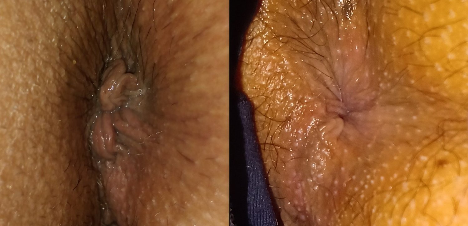 1 - my anus collection #YLExEMUG