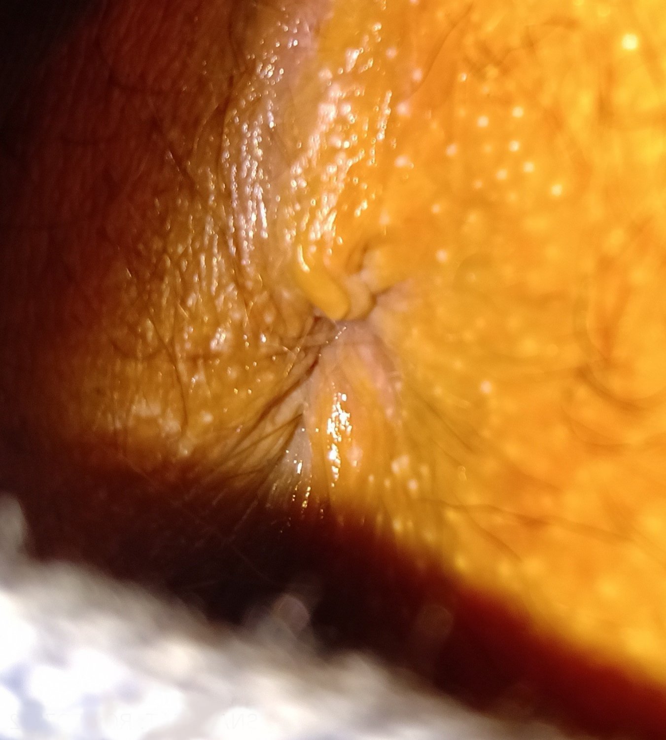 1 - my anus collection #iO2jDzt7