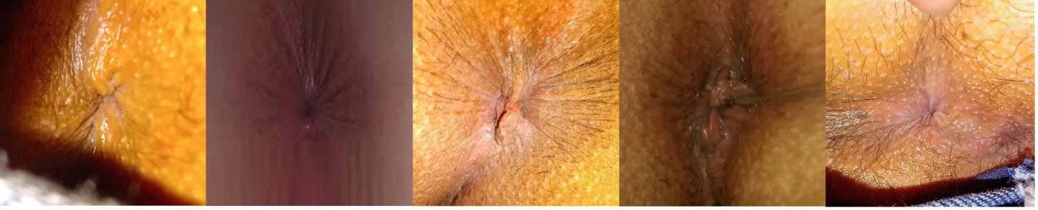 1 - my anus collection #nIEjCkm2