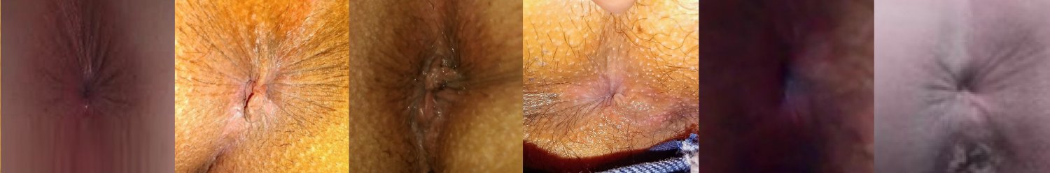 1 - my anus collection #rG5oPPfn