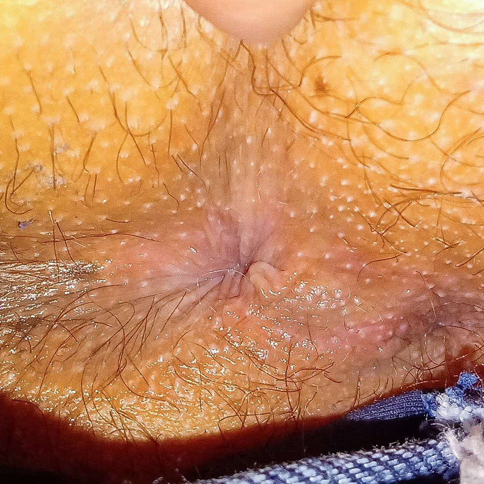 1 - my anus collection #wxw6Y1Lj