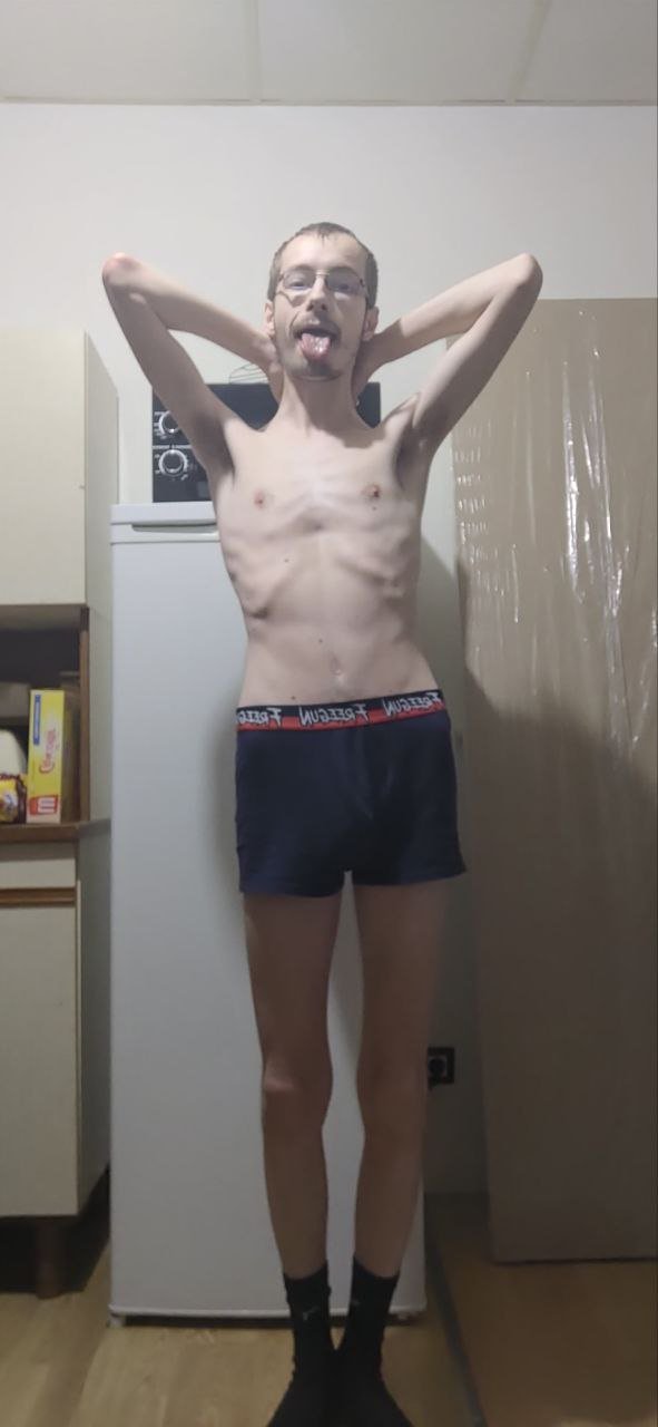 Skinny faggot Jonathan #0ePkdq3n