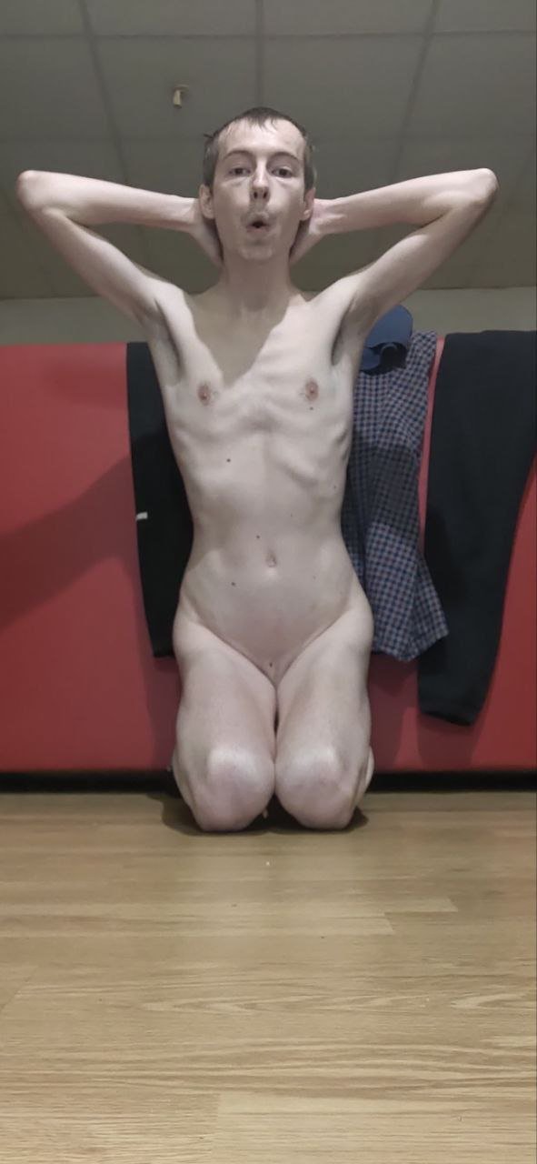 Skinny faggot Jonathan #Z7qzzxQn